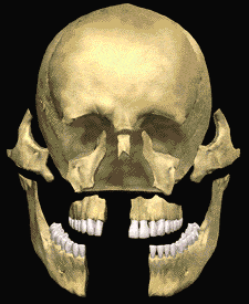Facial Trauma animation